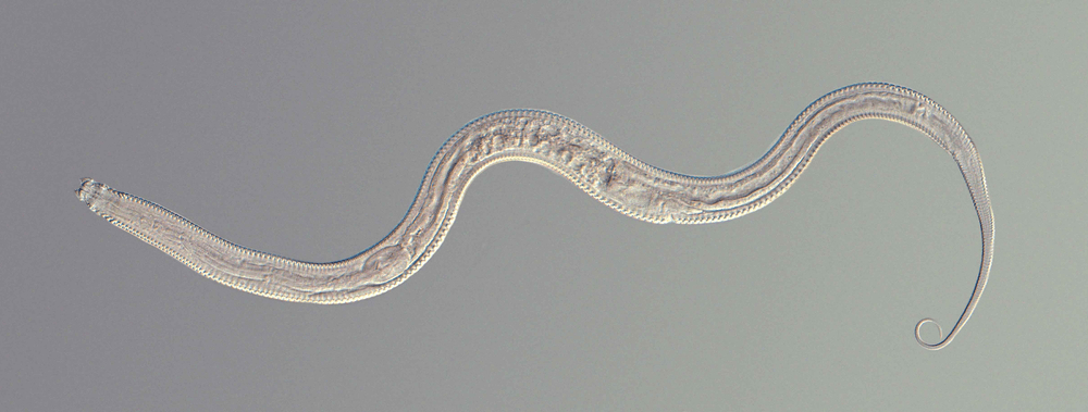 Microscopic view of a translucent nematode with an S-shaped body, showing visible internal parts.